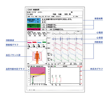 血圧脈波検査